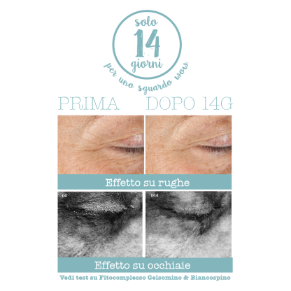 3 in 1 eye contour cream